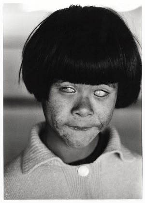 Blind girl by Christer Strömholm, Hiroshima, Japan 1963